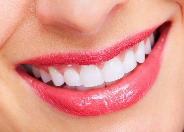 Bọc Răng Sứ Thẩm Mỹ